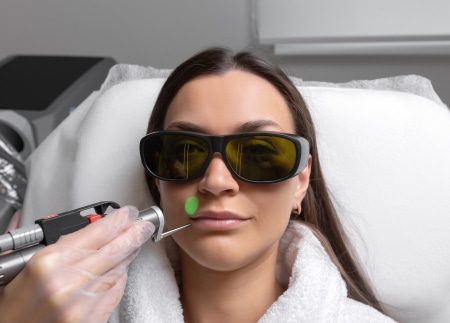 Epilation - Centre Laser Bel Air Bordeaux